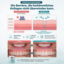 Lade das Bild in den Galerie-Viewer, CollaGum Pro – Intensive Zahnfleischpflege mit Kollagen & Hydroxylapatit