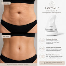 Lade das Bild in den Galerie-Viewer, Formkur - Anti-Cellulite Massagegerät für Bauch, Beine & Po