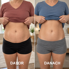 Lade das Bild in den Galerie-Viewer, Formkur - Anti-Cellulite Massagegerät für Bauch, Beine &amp; Po
