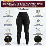 CelluForm 3D Anti-Cellulite-Leggings